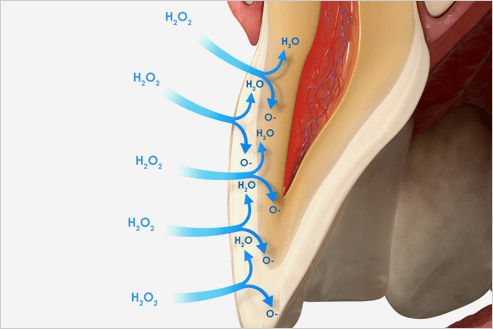 Image of whitening example